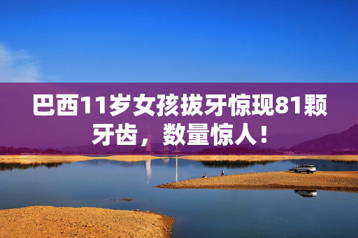 巴西11岁女孩拔牙惊现81颗牙齿，数量惊人！